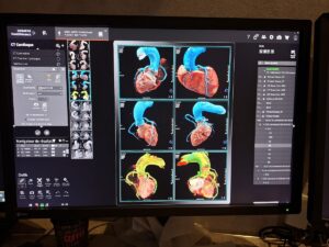 Centre d&rsquo;Imagerie Diagnostique et Interventionnelle de Soumbédioune