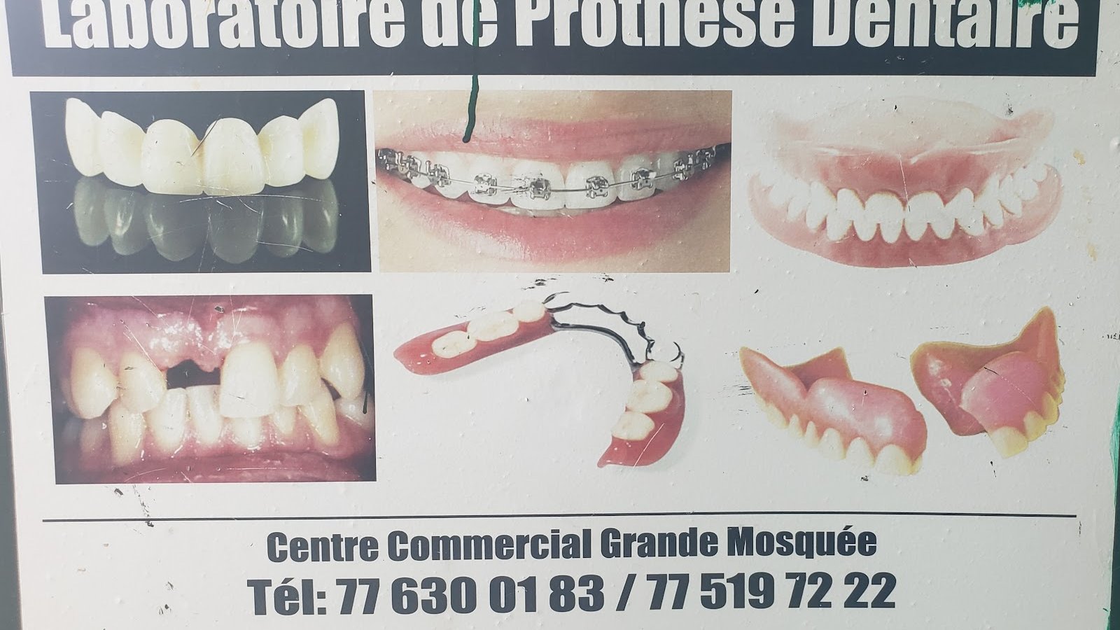 Laboratoire En Prothese Dentaire Dr Kassem Halaoui
